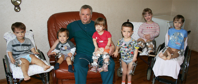 Achondroplasia Dwarfism Treatment